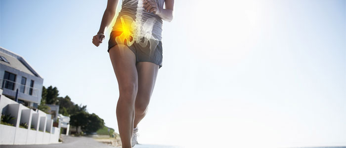 a woman running with sciatica